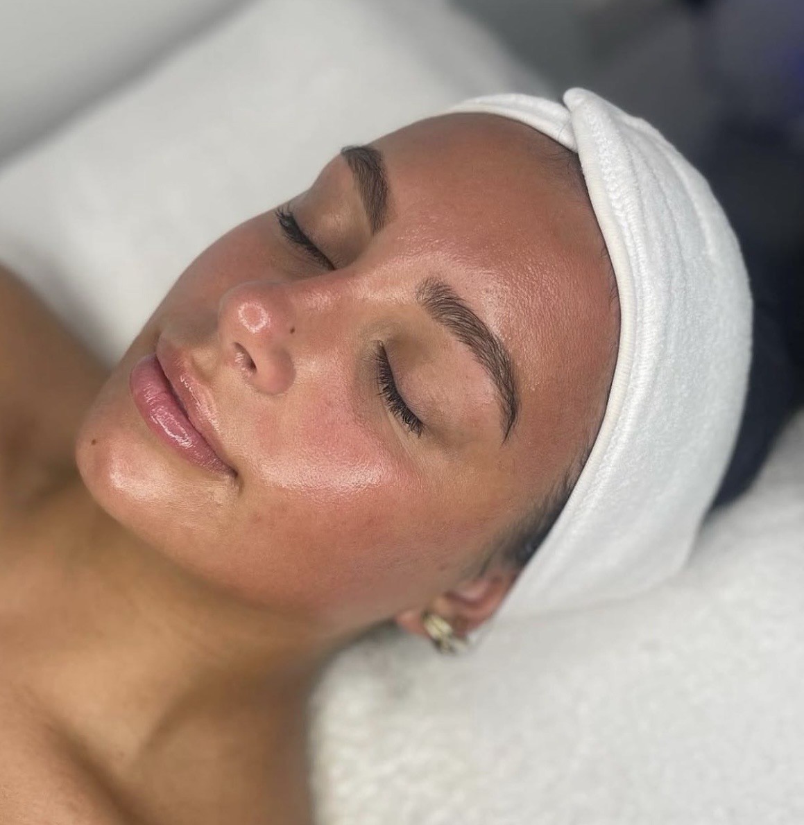 Gezichtsbehandeling bij Cavalèr Clinic in Groningen