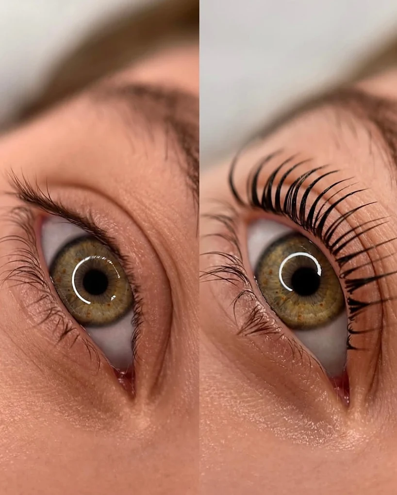 Lash lift resultaat bij Cavalèr Clinic