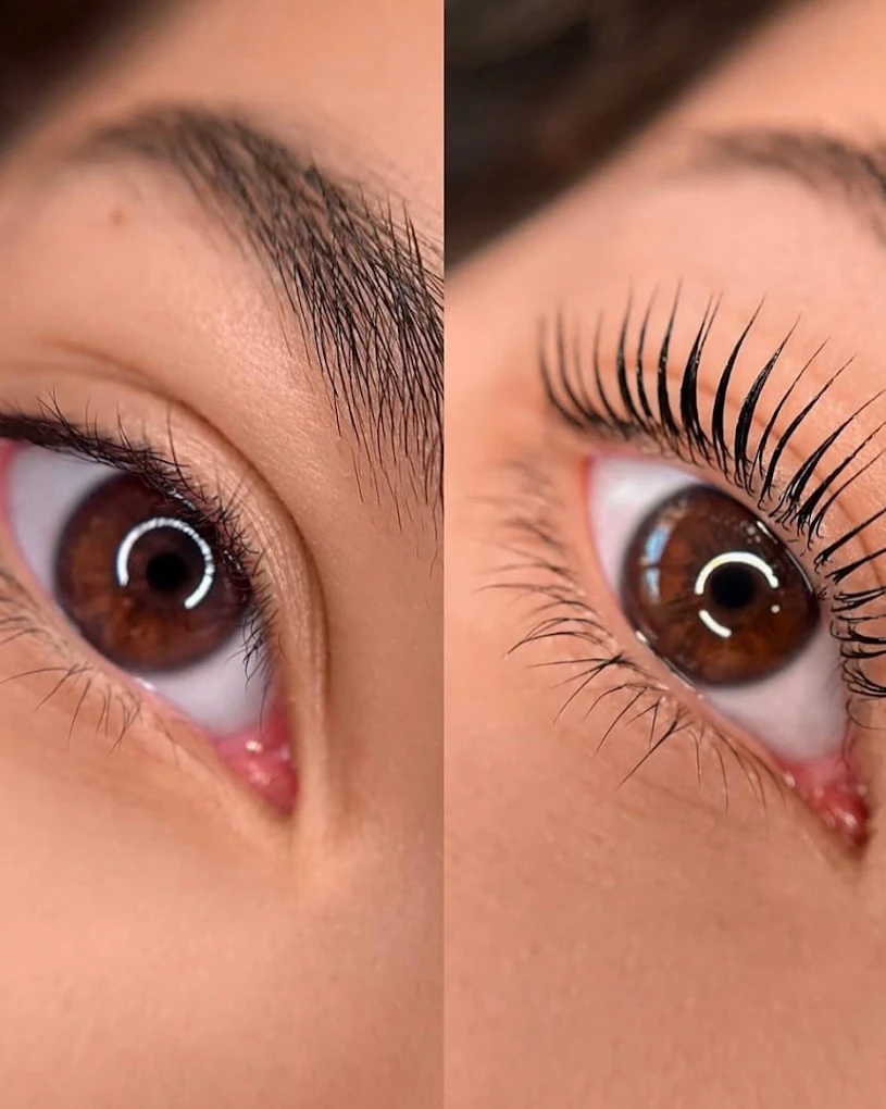 Lash lift behandeling bij Cavalèr Clinic in Groningen